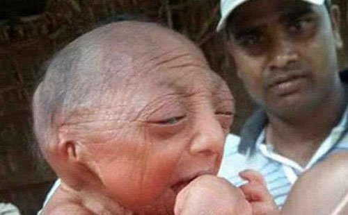 كۆرۈمسىز دەپ تاشلىۋىتىلگەن بوۋاق